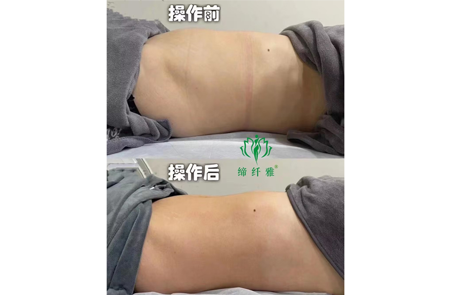 案例展示二
